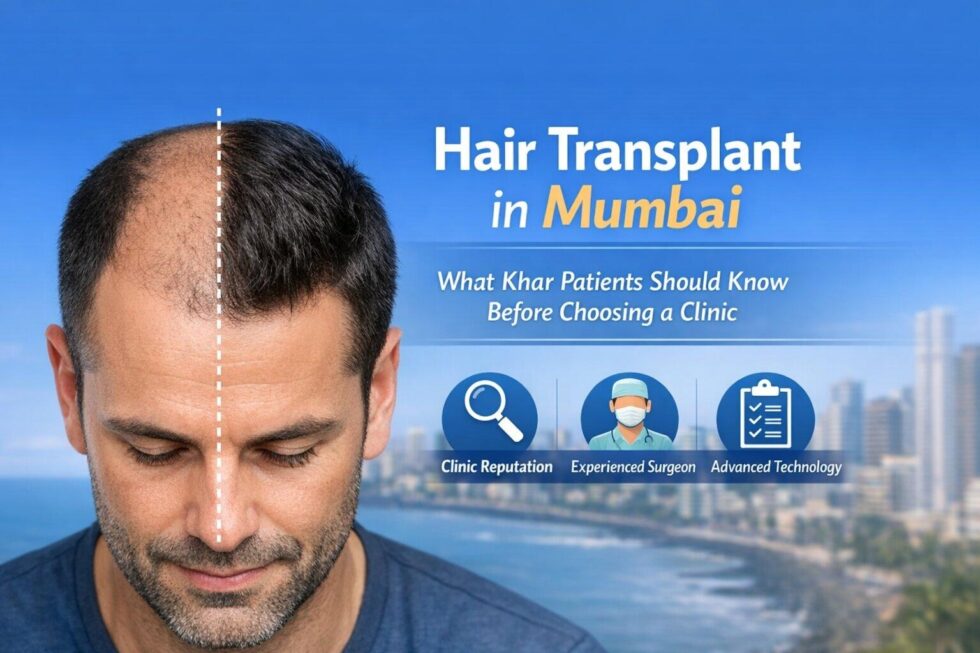 Hair Transplant in Mumbai: What Khar Patients Should Know Before Choosing a Clinic